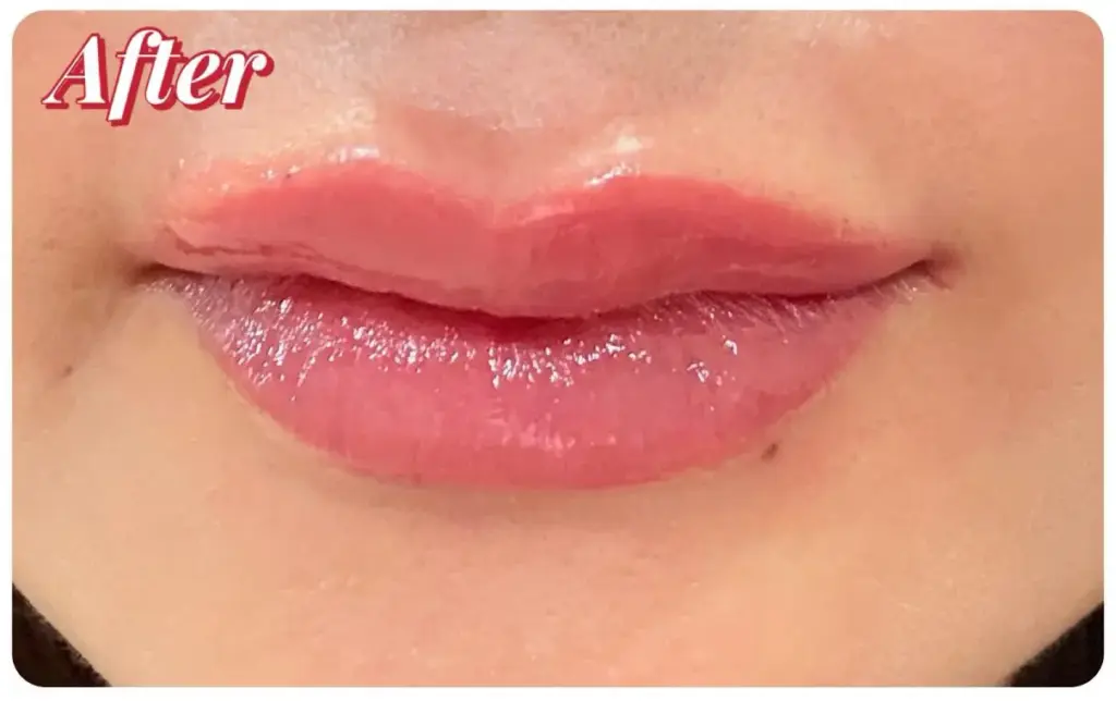 リップアートメイク術後
